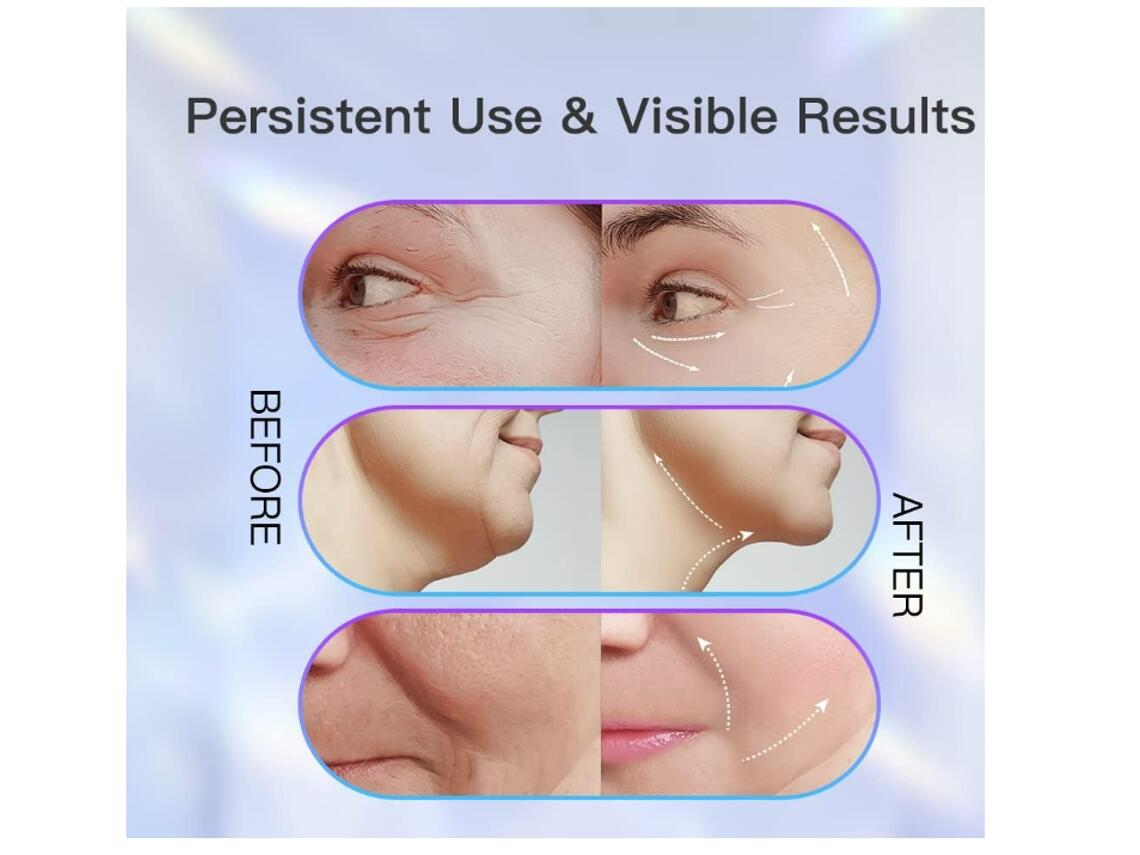 LumiSkin Pro – Dispositivo Facial LED 3 en 1