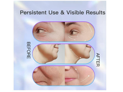 LumiSkin Pro – Dispositivo Facial LED 3 en 1